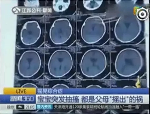 多名婴儿脑出血，，家长一个不经意的行动竟然对宝宝危险这么大1.webp.jpg